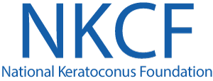 Corneal lifting technique reshapes ectactic cornea in keratoconus